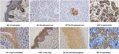 The distribution of heterophilic antigens and their relationship with autoimmune diseases